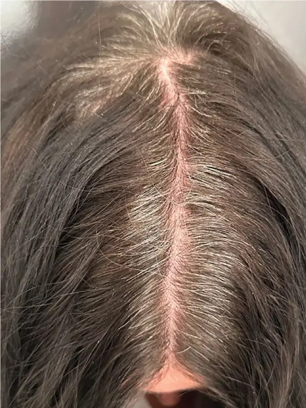 Before a root touch-up service showing visible hair regrowth at CocoRez in Port Coquitlam.